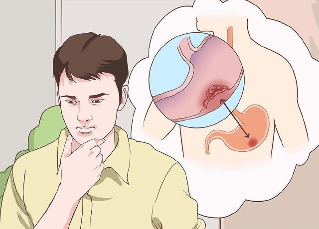 肛竇炎要當心，它可讓人不省心！