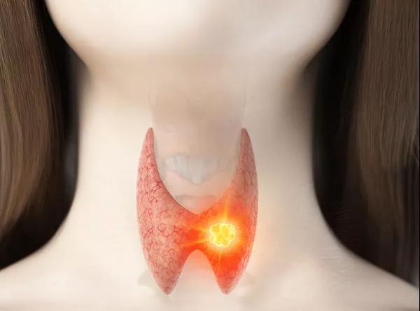 體檢查出這9種病，華西醫(yī)生：其實基本不用治！純屬自己嚇自己…(圖1)